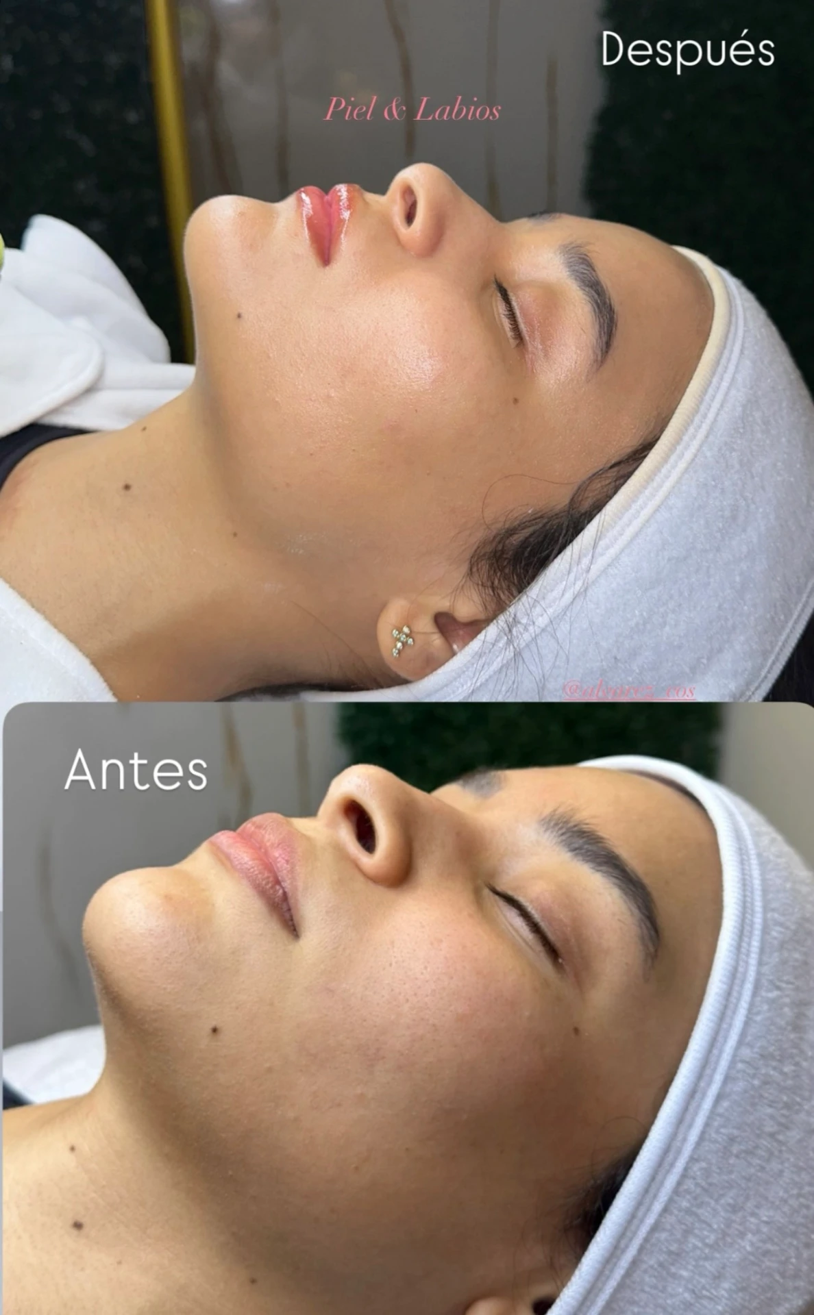 Antes y después: Cuidado de piel y labios