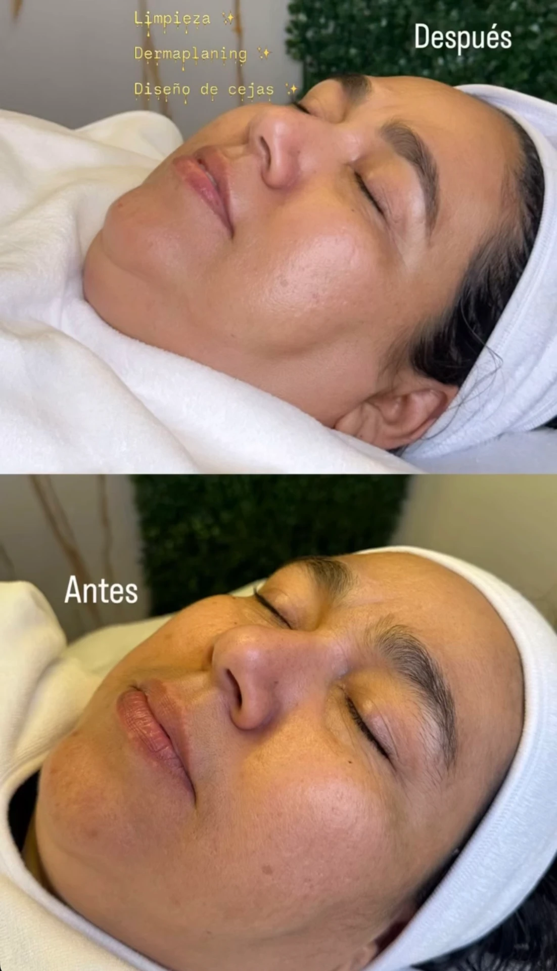 Antes y después: Limpieza, dermaplaning y diseño de cejas